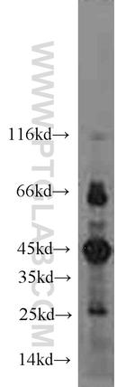 FLCN Antibody in Western Blot (WB)