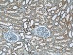 RHOT2 Antibody in Immunohistochemistry (Paraffin) (IHC (P))