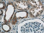 RHOT2 Antibody in Immunohistochemistry (Paraffin) (IHC (P))