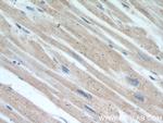 RHOT2 Antibody in Immunohistochemistry (Paraffin) (IHC (P))