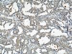 RHOT2 Antibody in Immunohistochemistry (Paraffin) (IHC (P))