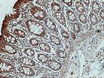 RHOT2 Antibody in Immunohistochemistry (Paraffin) (IHC (P))