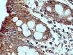 RHOT2 Antibody in Immunohistochemistry (Paraffin) (IHC (P))