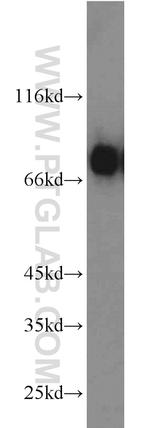 RHOT2 Antibody in Western Blot (WB)