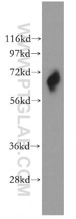 RHOT2 Antibody in Western Blot (WB)