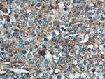 NDUFV1 Antibody in Immunohistochemistry (Paraffin) (IHC (P))