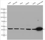 NDUFV1 Antibody in Western Blot (WB)