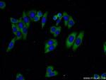 Cathepsin K Antibody in Immunocytochemistry (ICC/IF)