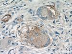 Cathepsin K Antibody in Immunohistochemistry (Paraffin) (IHC (P))