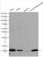 COXIV Antibody in Western Blot (WB)