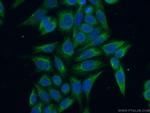 AASDHPPT Antibody in Immunocytochemistry (ICC/IF)