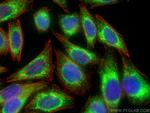 PDI Antibody in Immunocytochemistry (ICC/IF)