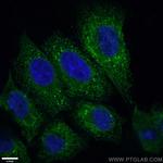 PDI Antibody in Immunocytochemistry (ICC/IF)