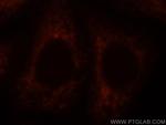 PDI Antibody in Immunocytochemistry (ICC/IF)