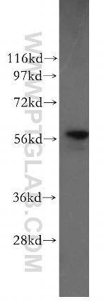 PDI Antibody in Western Blot (WB)