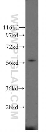 PDI Antibody in Western Blot (WB)