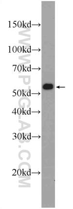 PDI Antibody in Western Blot (WB)