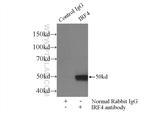 MUM1/IRF4 Antibody in Immunoprecipitation (IP)