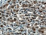 MUM1/IRF4 Antibody in Immunohistochemistry (Paraffin) (IHC (P))