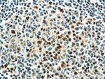 MUM1/IRF4 Antibody in Immunohistochemistry (Paraffin) (IHC (P))