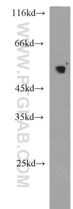 MUM1/IRF4 Antibody in Western Blot (WB)