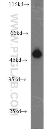 MUM1/IRF4 Antibody in Western Blot (WB)