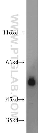MUM1/IRF4 Antibody in Western Blot (WB)