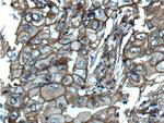 S100A10 Antibody in Immunohistochemistry (Paraffin) (IHC (P))