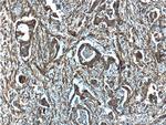 S100A10 Antibody in Immunohistochemistry (Paraffin) (IHC (P))