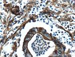 S100A10 Antibody in Immunohistochemistry (Paraffin) (IHC (P))