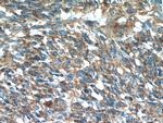 S100A10 Antibody in Immunohistochemistry (Paraffin) (IHC (P))