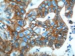 S100A10 Antibody in Immunohistochemistry (Paraffin) (IHC (P))