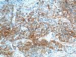 S100A10 Antibody in Immunohistochemistry (Paraffin) (IHC (P))