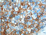 S100A10 Antibody in Immunohistochemistry (Paraffin) (IHC (P))