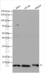 S100A10 Antibody in Western Blot (WB)