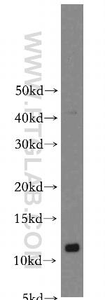 S100A10 Antibody in Western Blot (WB)