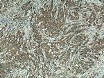 GLRX3 Antibody in Immunohistochemistry (Paraffin) (IHC (P))