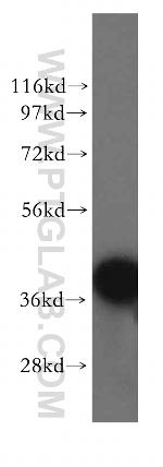 RAD51AP1 Antibody in Western Blot (WB)