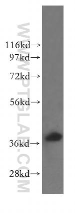 RAD51AP1 Antibody in Western Blot (WB)