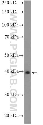 RAD51AP1 Antibody in Western Blot (WB)