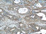 Annexin A2 Antibody in Immunohistochemistry (Paraffin) (IHC (P))