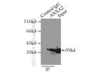 Annexin A2 Antibody in Immunoprecipitation (IP)