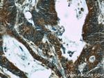 ERK1/2 Antibody in Immunohistochemistry (Paraffin) (IHC (P))