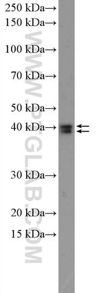 ERK1/2 Antibody in Western Blot (WB)