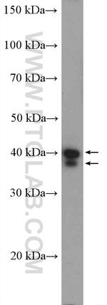 ERK1/2 Antibody in Western Blot (WB)