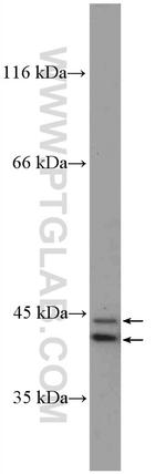 ERK1/2 Antibody in Western Blot (WB)