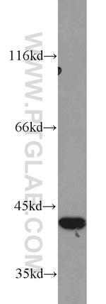 ERK1/2 Antibody in Western Blot (WB)