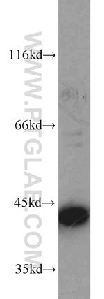 ERK1/2 Antibody in Western Blot (WB)