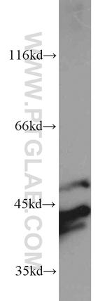 ERK1/2 Antibody in Western Blot (WB)