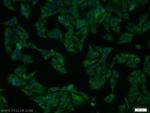 ERK1/2 Antibody in Immunocytochemistry (ICC/IF)